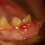 TR-FORL-tandsygdomme-hos-katte-www.kattensliv.dk